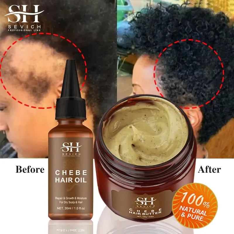 African Crazy Hair Growth Spray